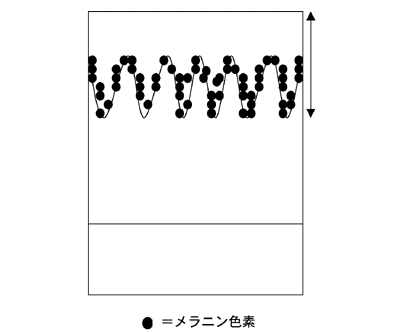 図2：シミ（老人性色素斑）の内部構造