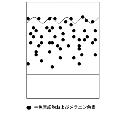 図3：アザ（太田母斑）の内部構造