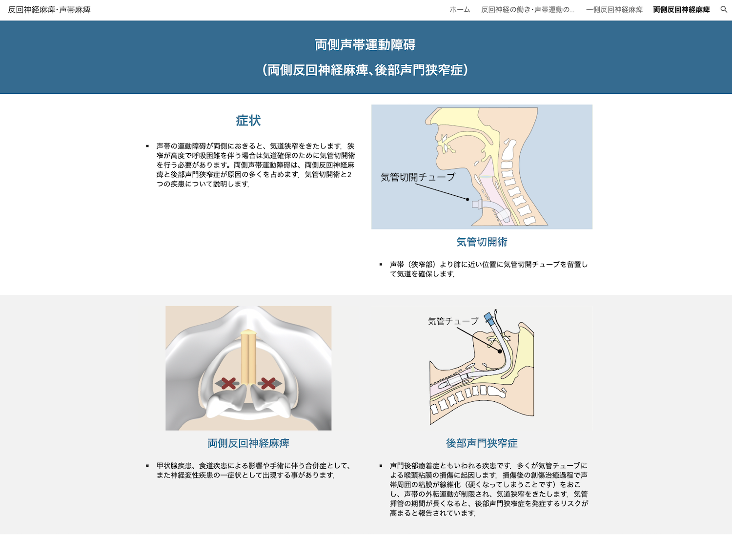 反回神経麻痺外来4