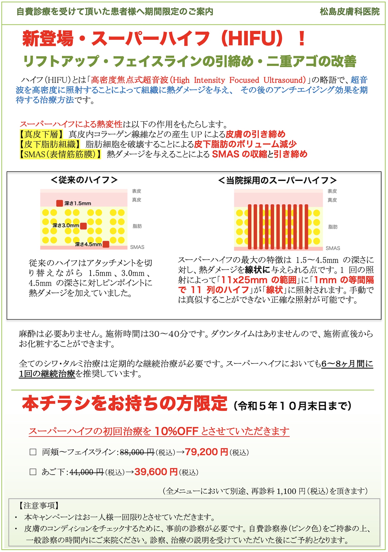 スーパーハイフ（Super HIFU）2023キャンペーン